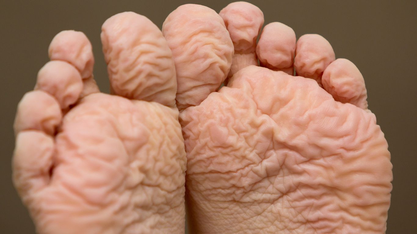 what does athlete's foot look like
